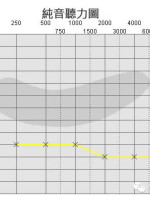 听力小百科：您会看听力图吗？