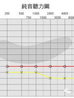 听力小百科：您会看听力图吗？