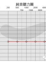 听力小百科：您会看听力图吗？