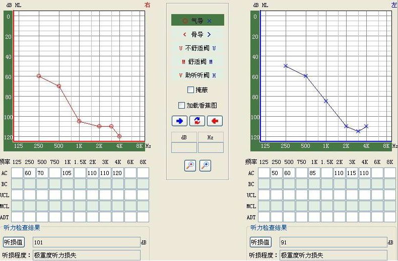 听力小百科：您会看听力图吗？